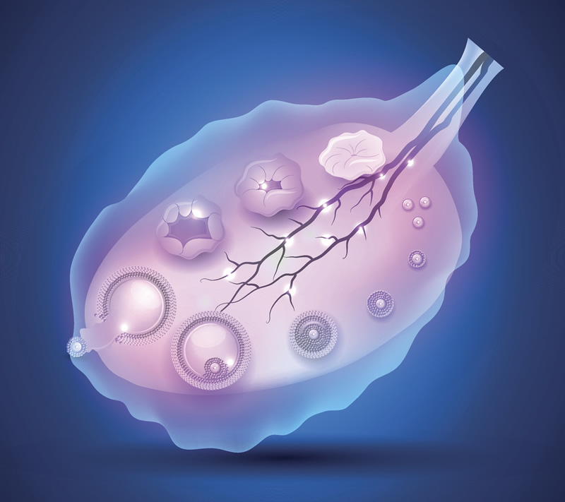 〖数据说话保定试管助孕费用明细,微刺激方案适合多囊人群吗？〗
